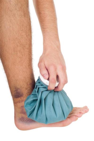 Ice ankle sprain Ice ankle sprain