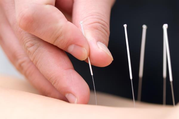 Headache physio Headache physio